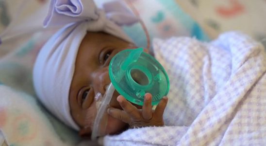 Dünyanın Yaşamda Kalmayı Başaran En Minik Bebeği Saybie ile Tanışın Video