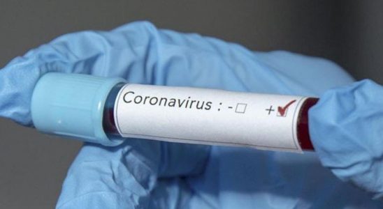 Suriye, İlk Koronavirüs Vakasını Resmen Doğruladı